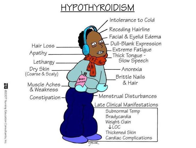 Hypothyroidism