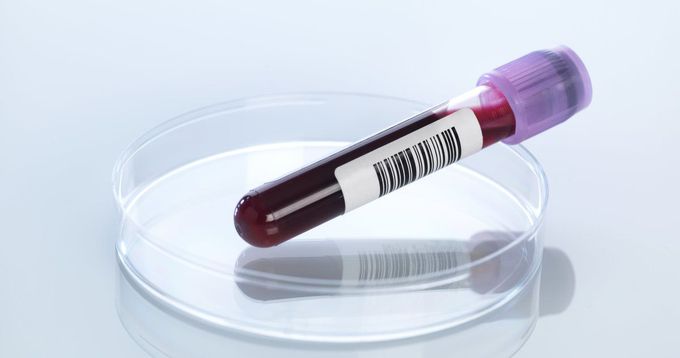 New Blood Test That Detects Pancreatic Cancer Early Could Be Available In Two Years