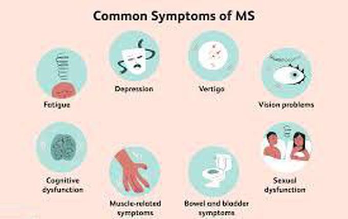 These are the symptoms of multiple sclerosis