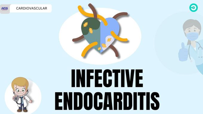 Infective Endocarditis: pathophysiology, symptoms, diagnosis & Treatment