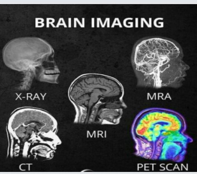 Brain Imaging