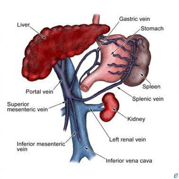 Portal hypertension