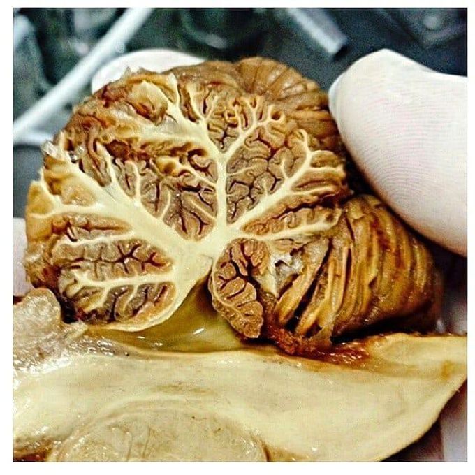 Cerebellem