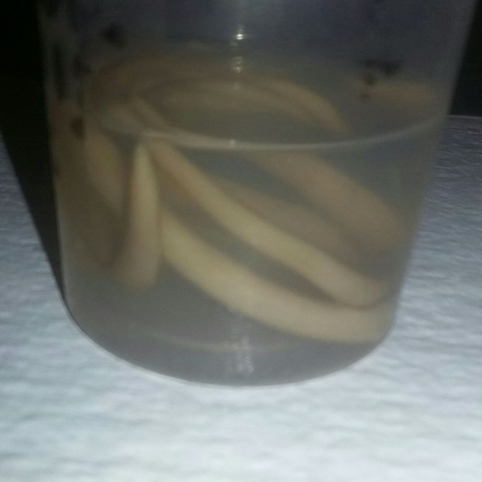 Ascaris Lumbricoides