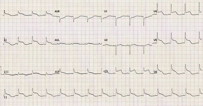 Medical case