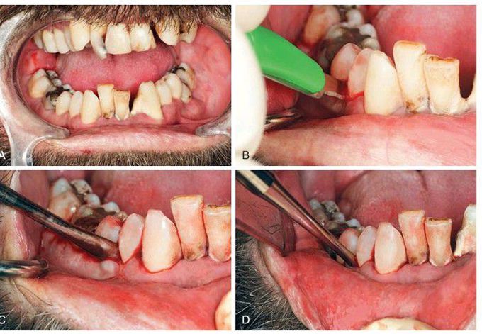 Multiple extractions