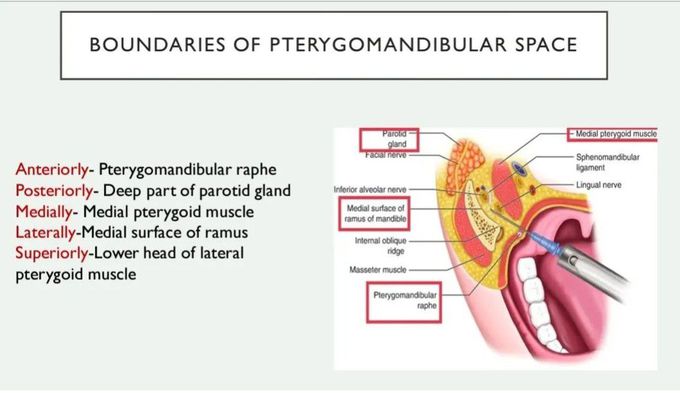 Pterygomandibular Space