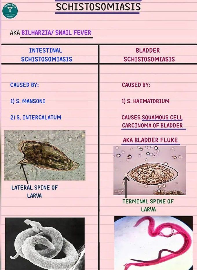 Schistosomiasis