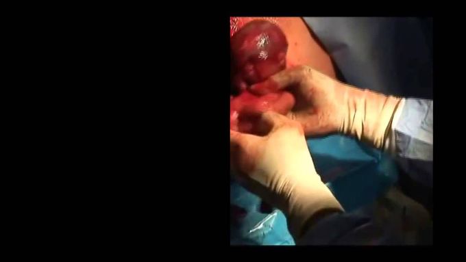 LIVE Abortion Video on Display in Washington, DC Jan. 21-22