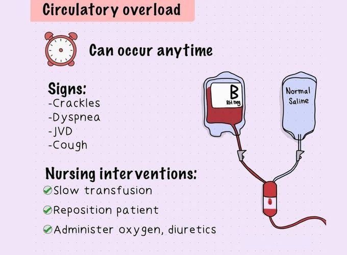 Circulatory Overload