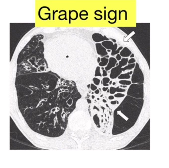 Grape Sign