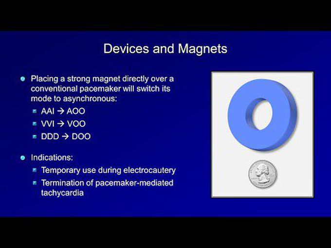 ICDs and Biventricular Pacemakers-
made easy