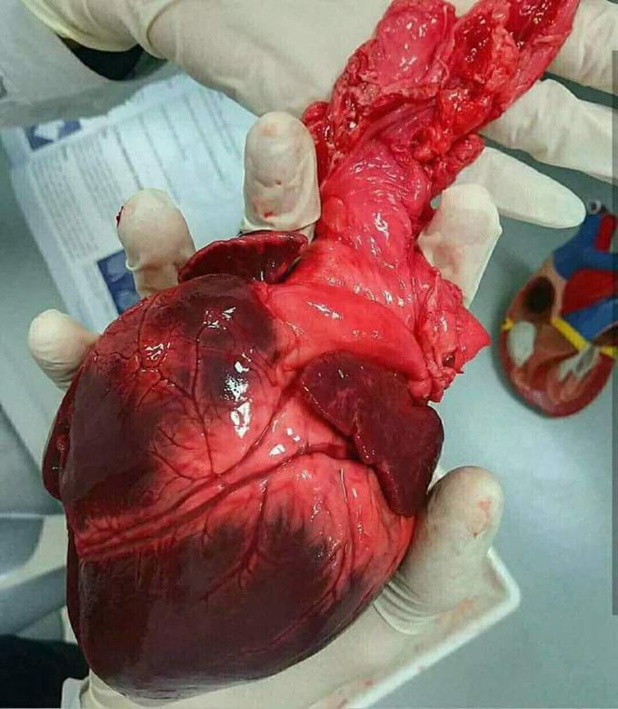 Heart