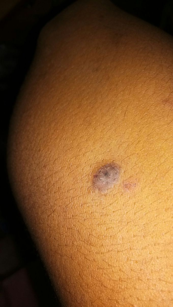 How to remove this spot