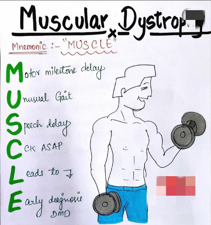 Muscles