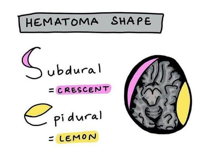 Hematoma