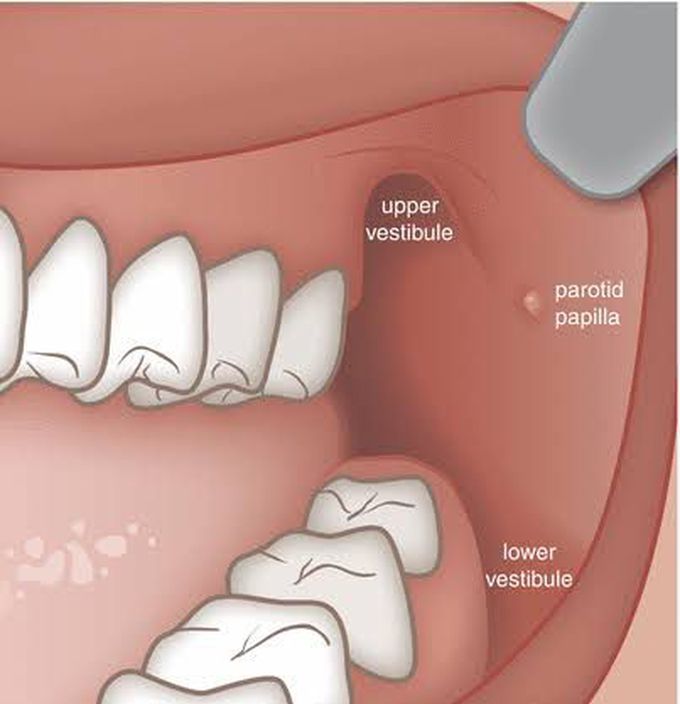 Buccal vestibule