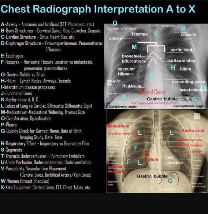 Thorax radiograph