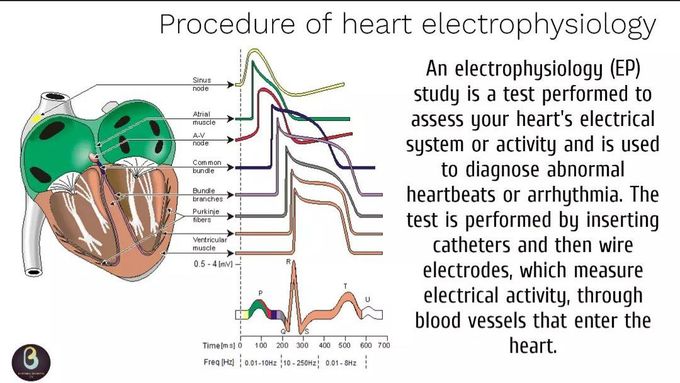 Heart Electrophysiology