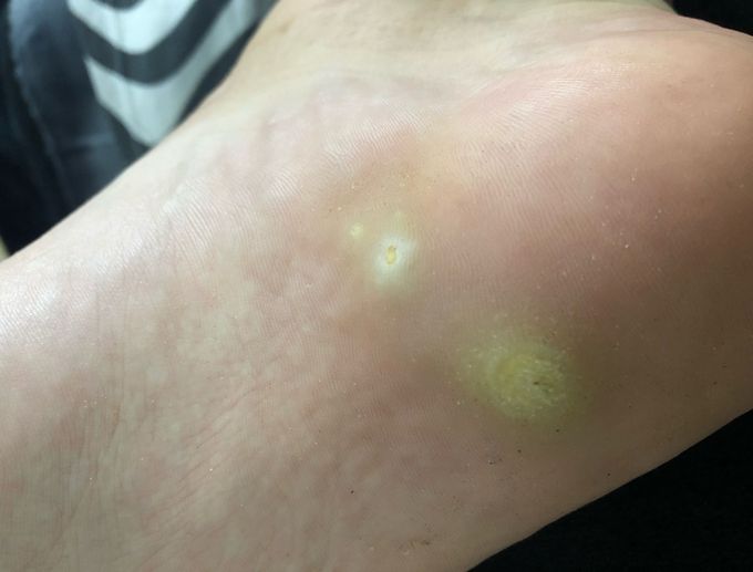 Diagnosis?!