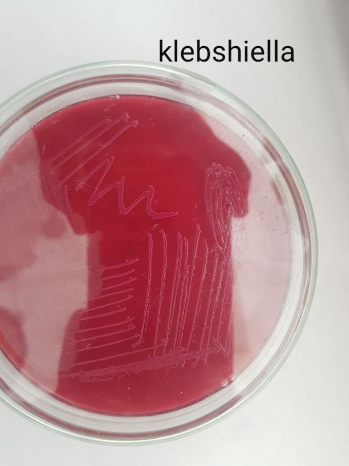 Culture of klebsiella