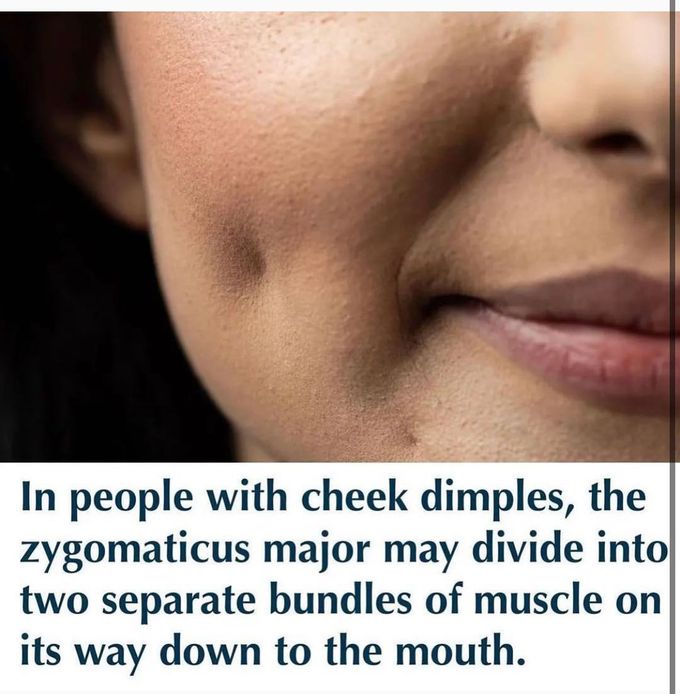 What are cheek dimples?