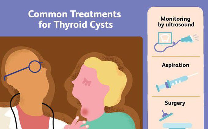 These are some common treatments for Thyroid cysts