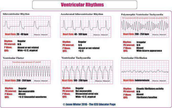 ECG - MEDizzy