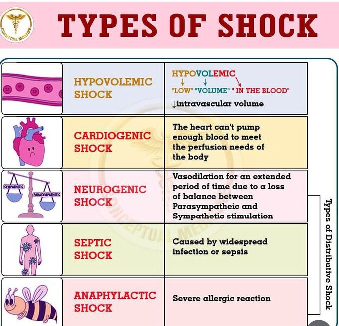 Types of Shock