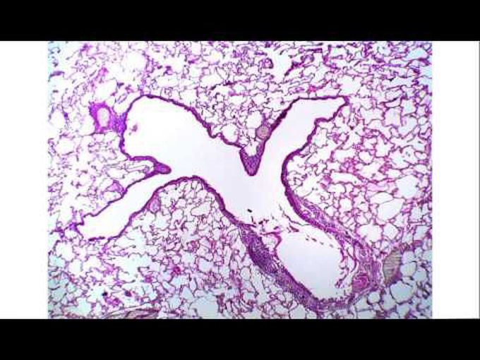 Histology of Alveolar Duct