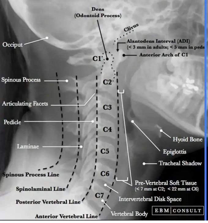 Head and Neck Radiology