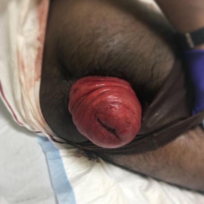 What is your diagnosis?