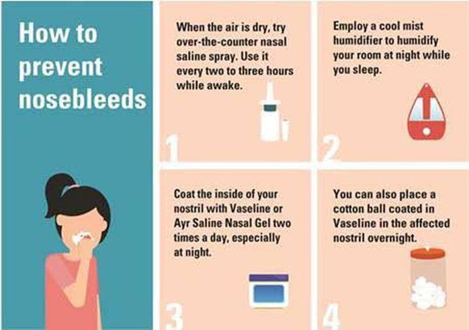 Here are some tips to prevent nosebleeds