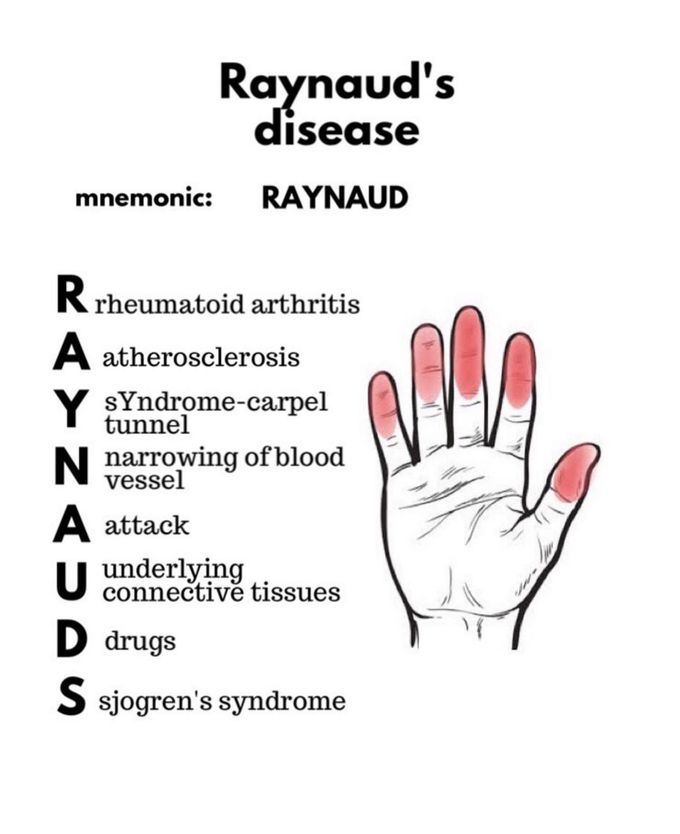 Raynaud's Disease