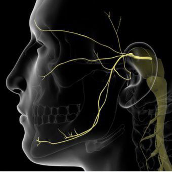 Treatment of Trigeminal Neuralgia