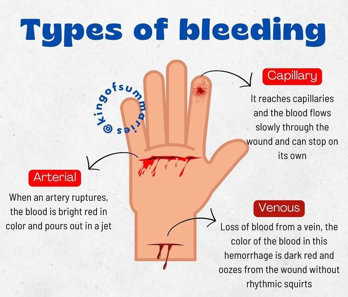 Types of Bleeding - MEDizzy