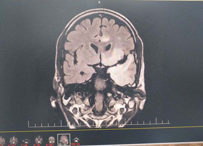 What is your diagnosis?