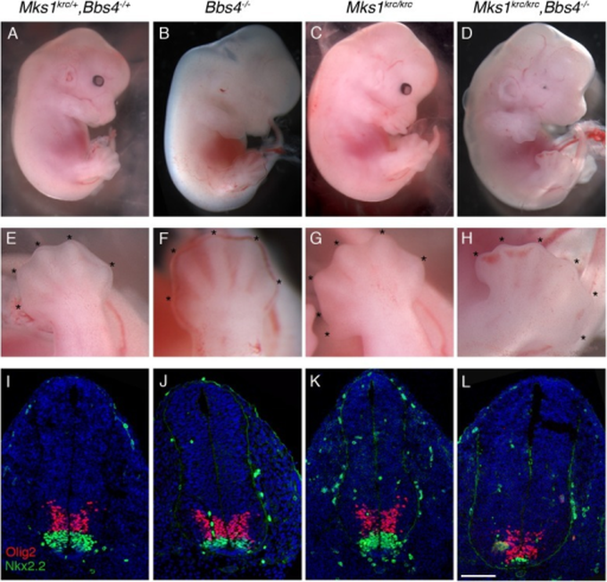 Cause of Meckel-Gruber syndrome