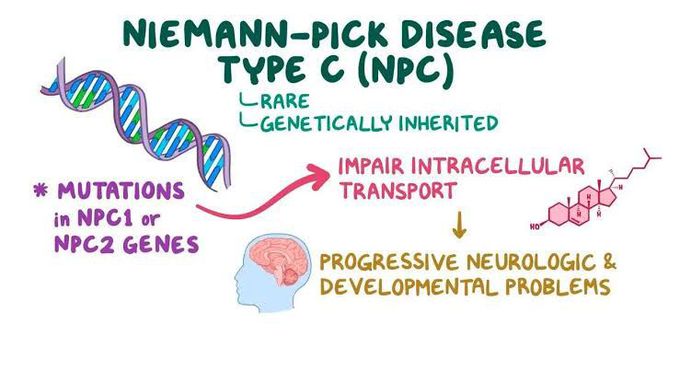 Neimann picks disease