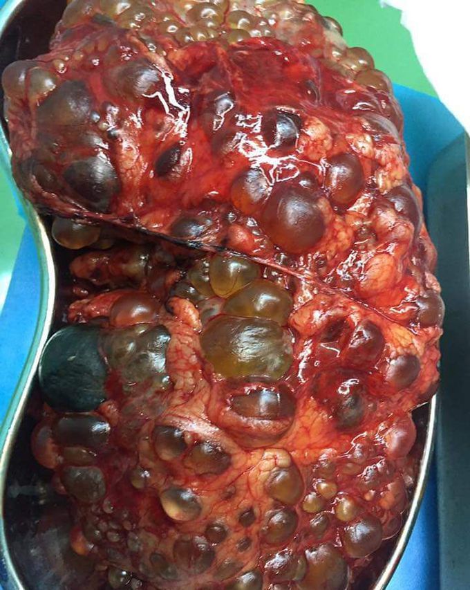 Whats your diagnosis? 
