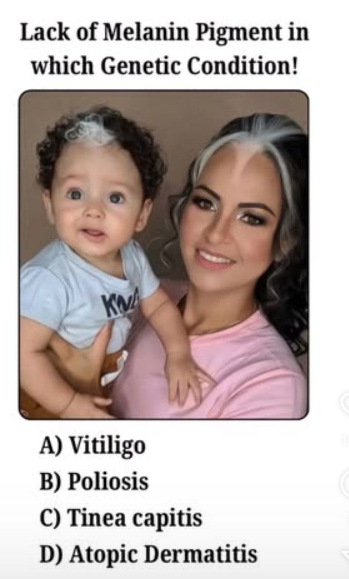 Identify the Genetic Condition