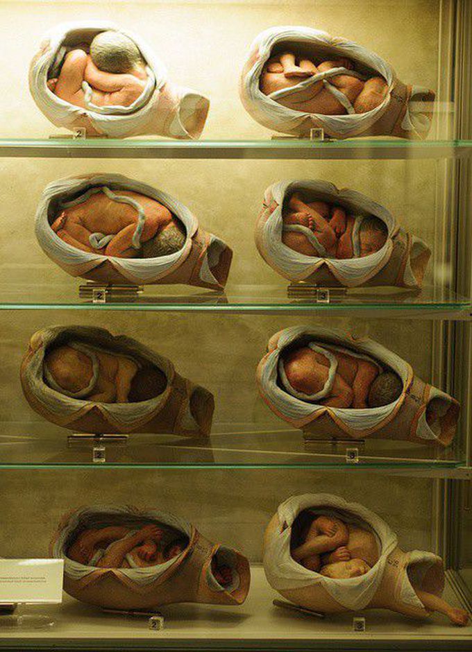 Obstetrics
