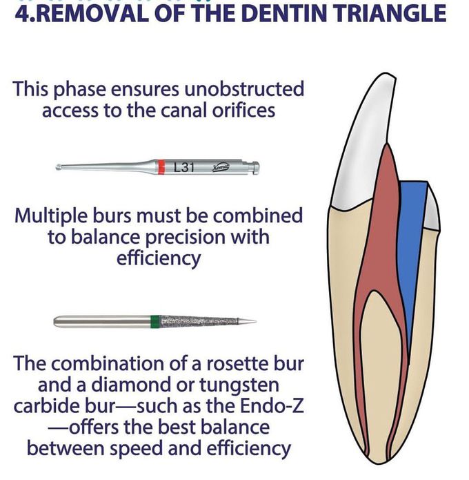 Access Cavity- Phase 4