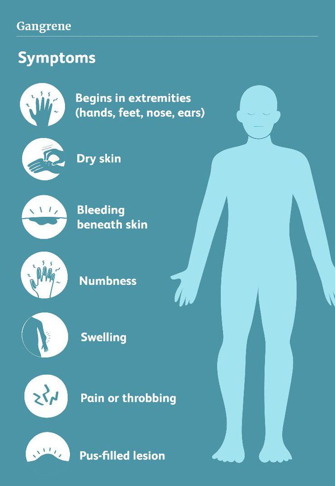 Symptoms of Gangrene