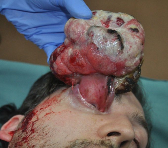 Amazing medical case :O