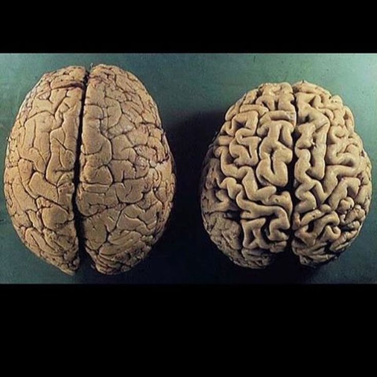 Старый новый мозг