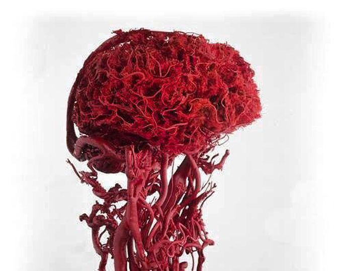 Blood vessels of human neck and brain