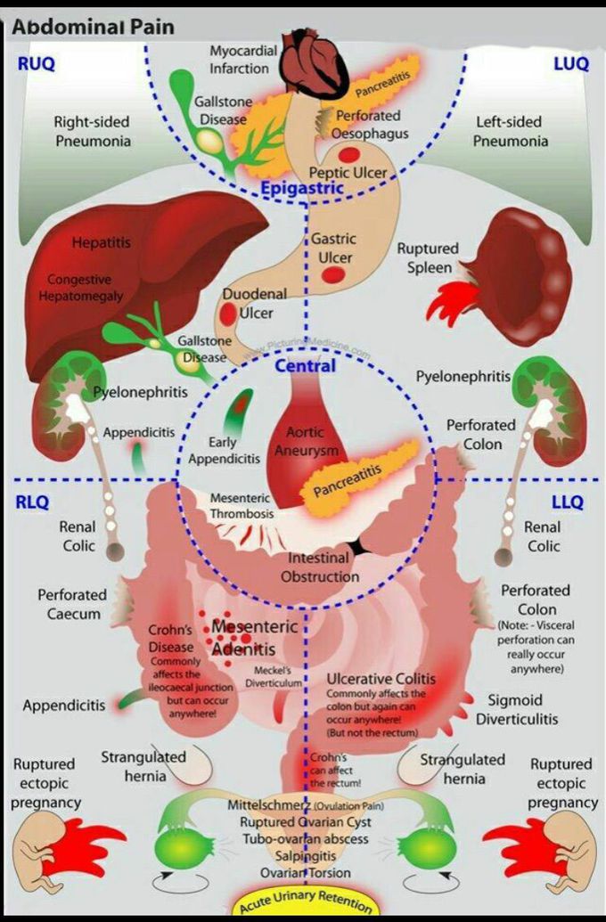 Abdominal pain