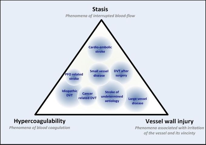 Virchow's Triad