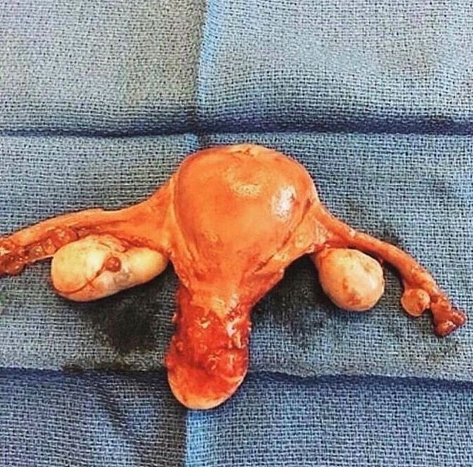 What do you seen in the picture